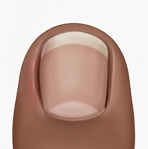 Illustration of a big toe with an early ingrown toenail: the skin along the left side of the nail is slightly swollen and deeper in tone, with no discharge.